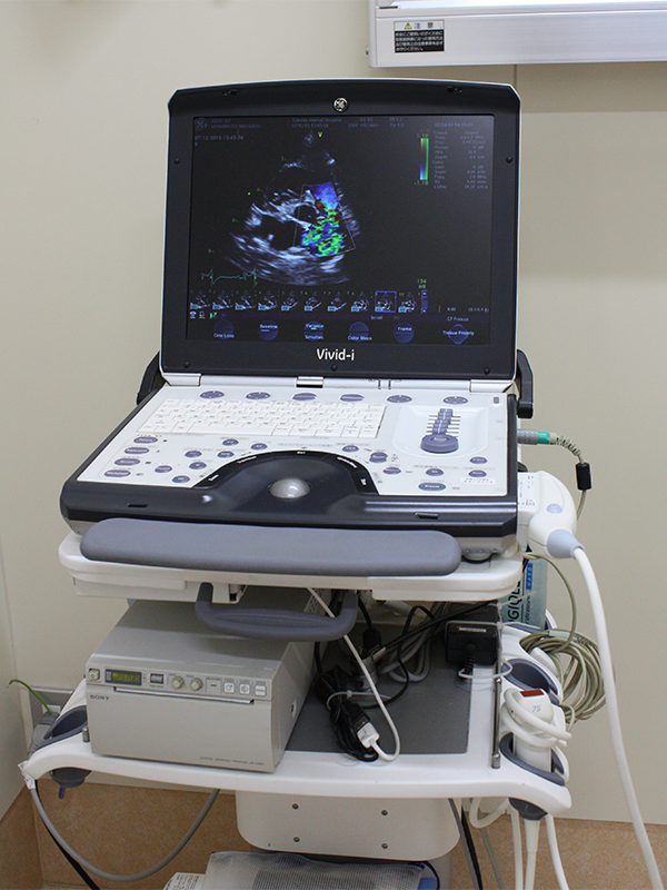 心臓病専用の超音波装置